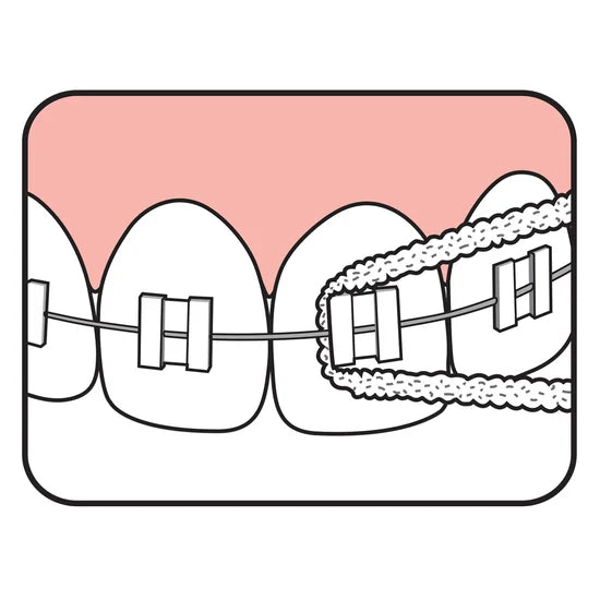TePe Bridge & Implant Floss 30 st