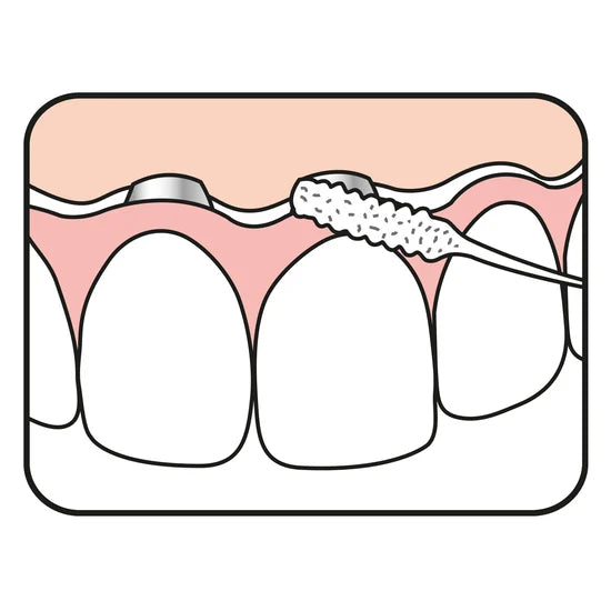 TePe Bridge & Implant Floss 30 st
